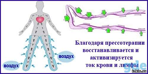 Аппарат прессотерапии(лимфодренаж), фотография 4