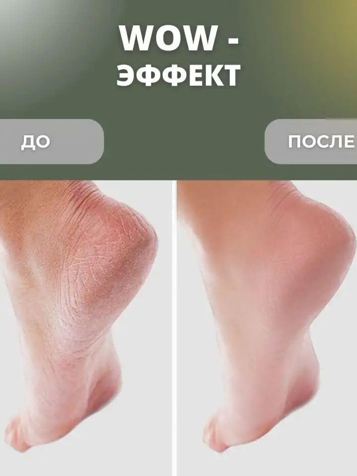 Крем для ног и пяток от трещин увлажняющий 150 мл, фотография 5