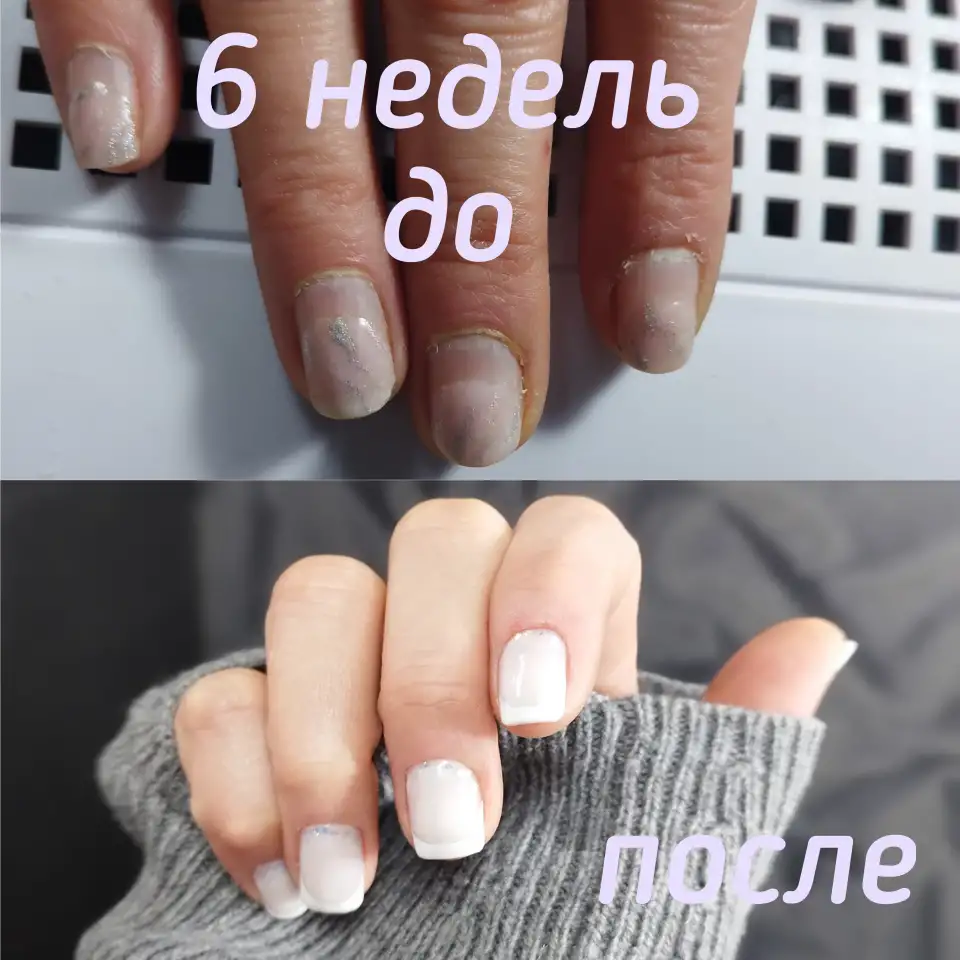 Маникюркоррекция ногтей, фотография 5