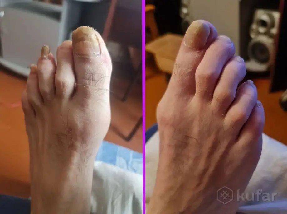 Стрижка ногтей педикюр маникюр, фотография 2