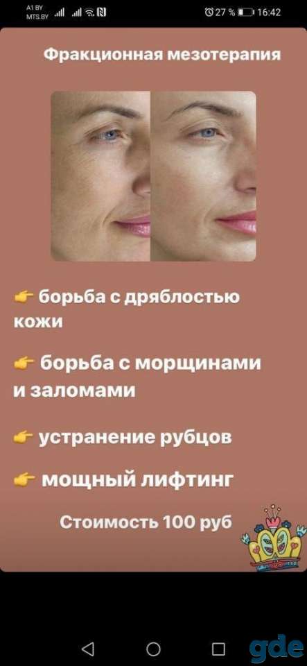 Косметологические услуги, массаж., фотография 7