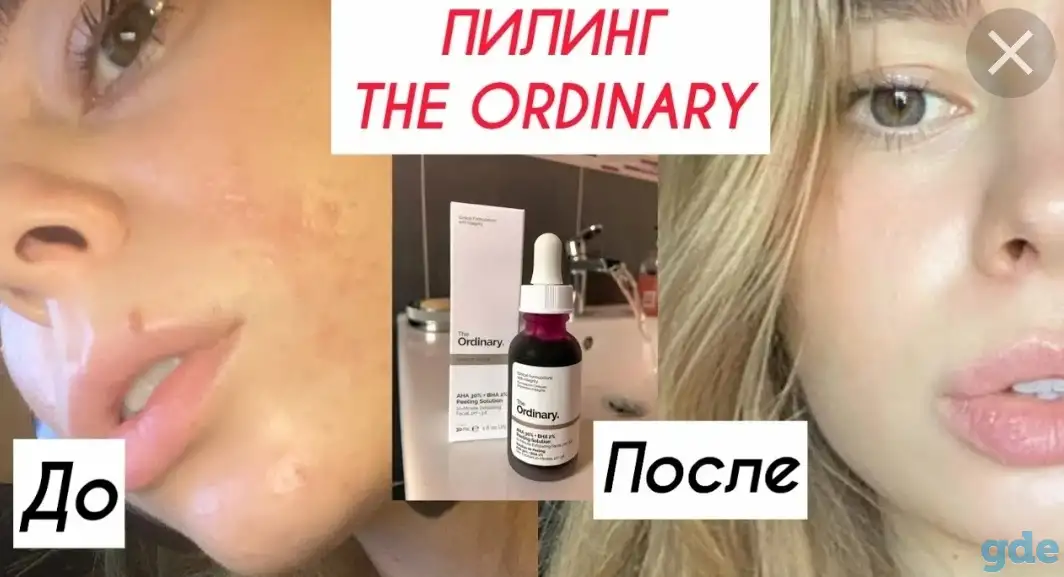 Пилинг, фотография 1