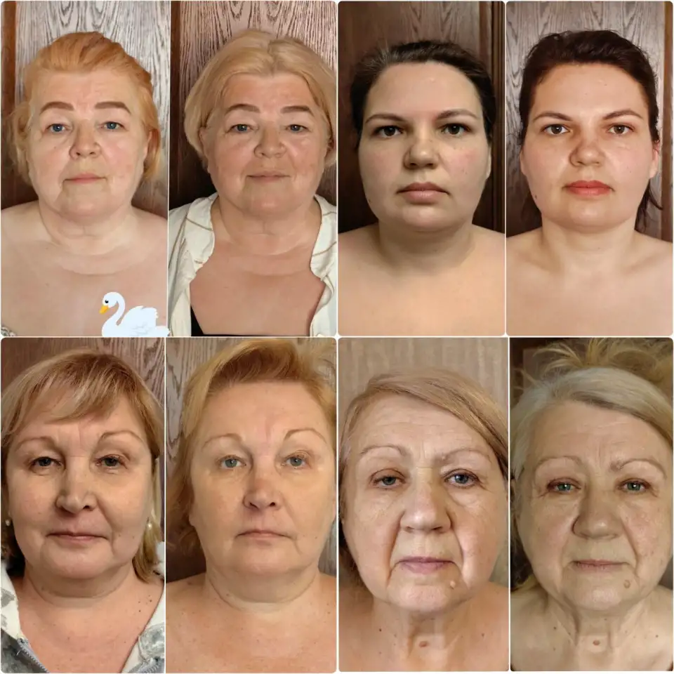 Сплитмассаж. Омоложение лица естественным способом. ., фотография 2