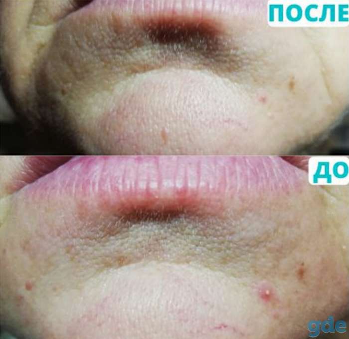Косметология, фотография 3