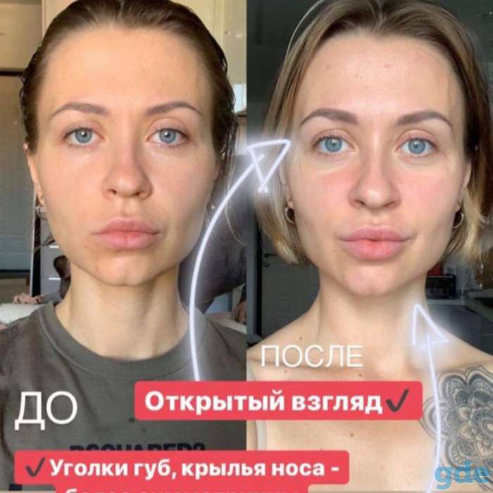 Коллаген, фотография 4