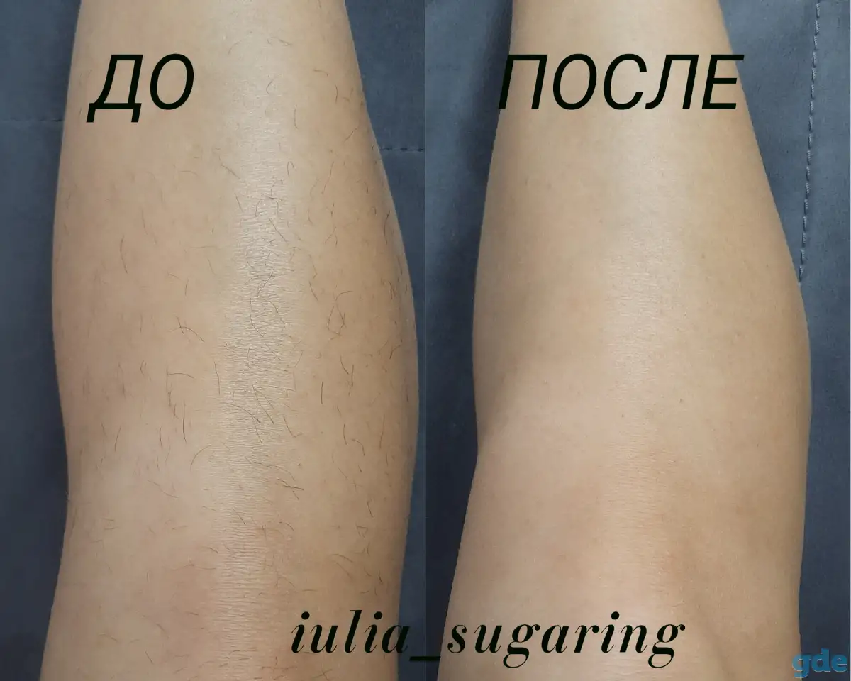 Депиляция/Шугаринг, фотография 1