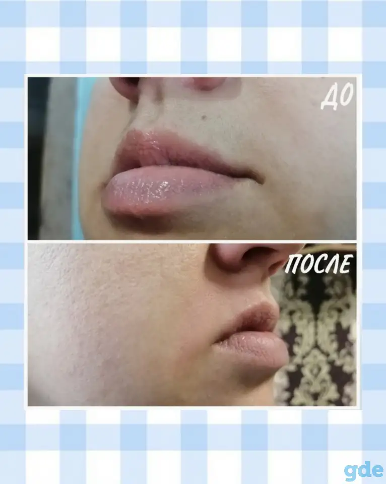 Депиляция воском и сахаром, фотография 2