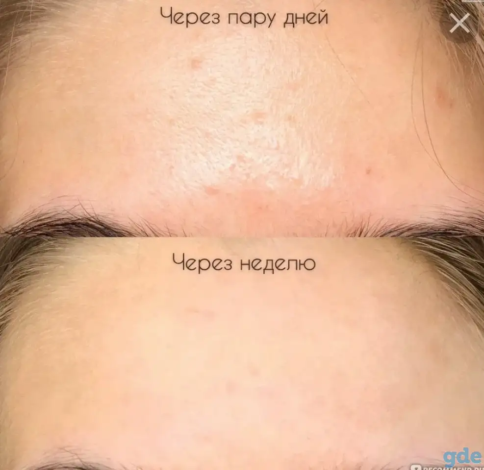 Сыворотка Ординари, фотография 3