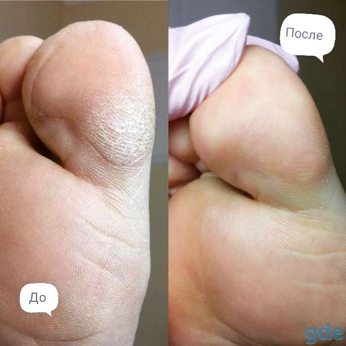 Педикюр, фотография 4