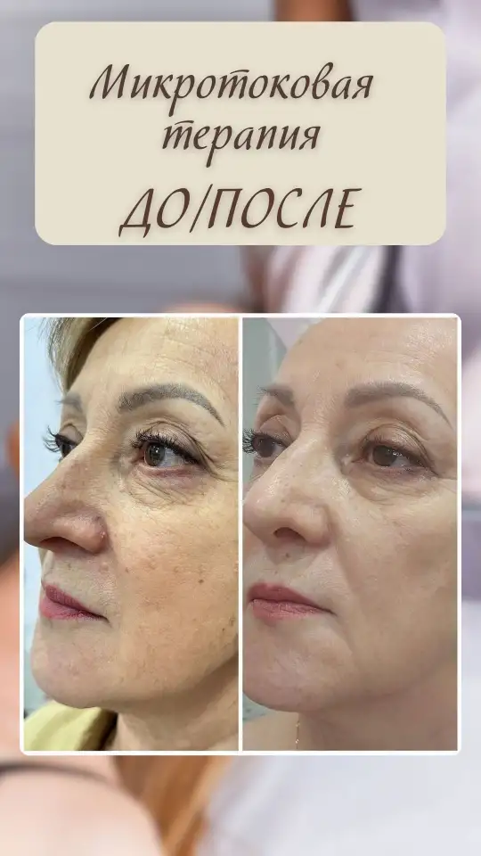 Массаж для похудения, фотография 4