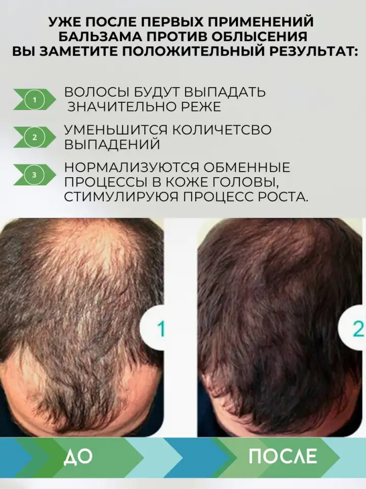 Бальзам маска для волос защита от выпадения и облысения, фотография 4