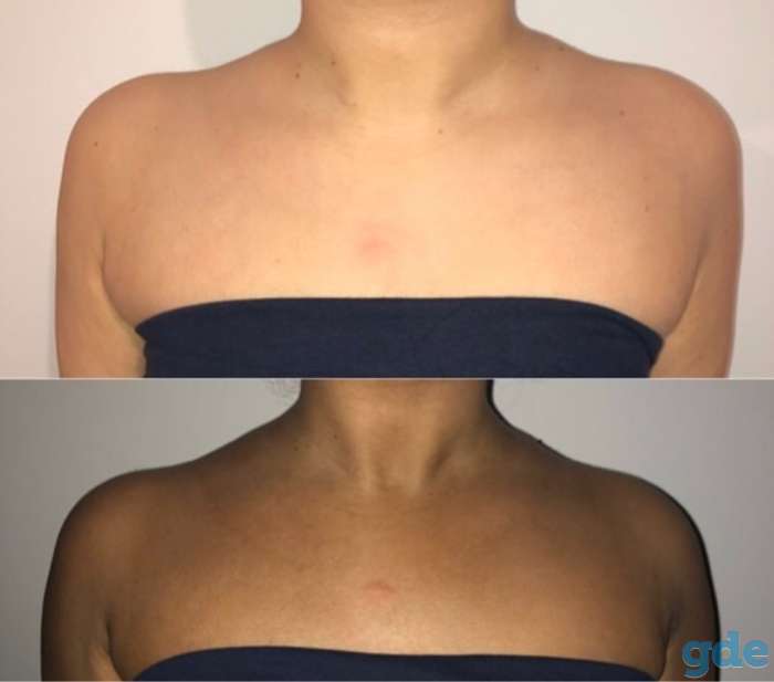 Продам автозагары австралийского бренда MineTan, фотография 5