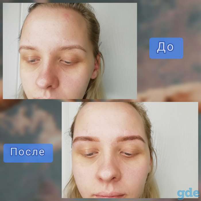 Бровист, фотография 1