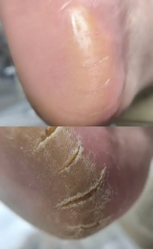 Маникюр. Педикюр., фотография 5