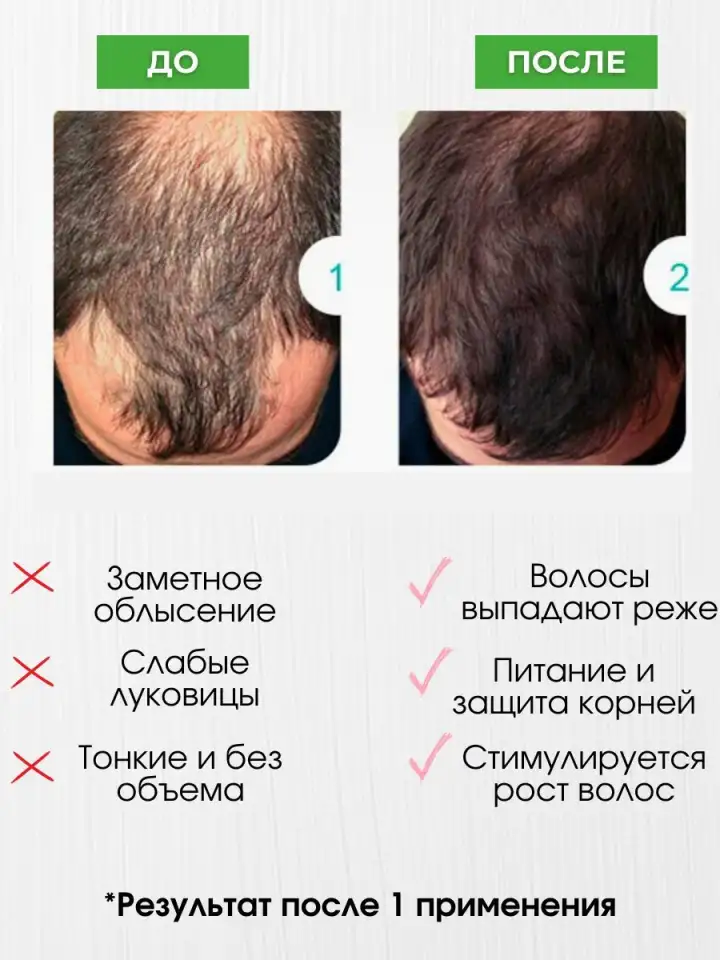 Шампунь для роста волос и бальзам против облысения, фотография 4