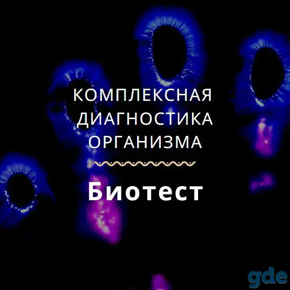 Биотест. NLS диагностика организма на наличие паразитарной микрофлоры, фотография 1