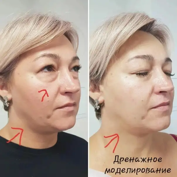 Массаж Сморгонь, фотография 7