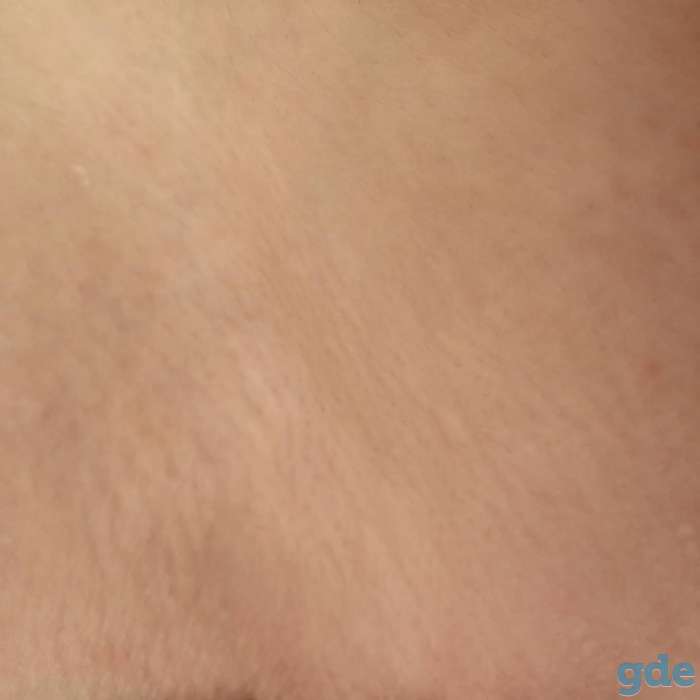 Шугаринг |депиляция, фотография 6