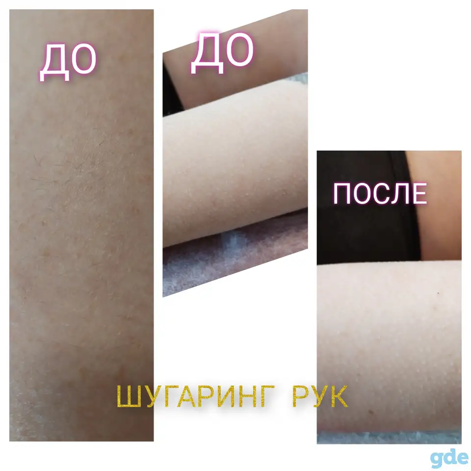 Шугаринг, фотография 4