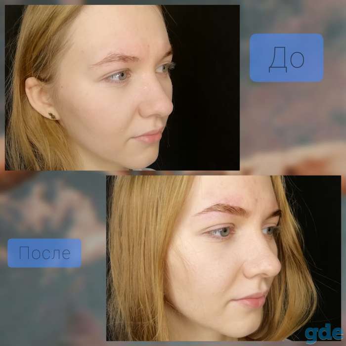 Бровист, фотография 4