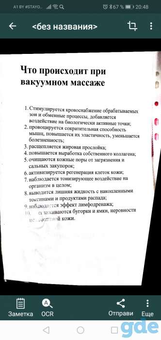 Классический, антицеллюлитный-баночный массаж., фотография 5
